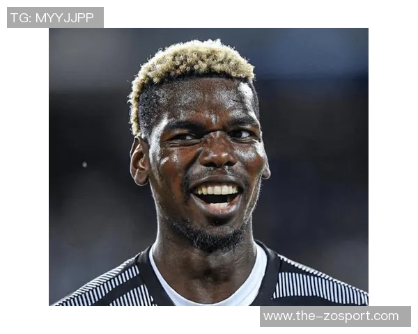 博格巴加盟后伤病不断本周再度受伤复出成疑